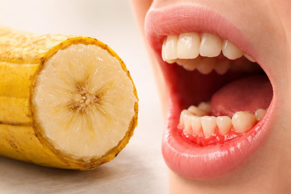 Banane et gingivite ce fruit peut nuire a vos gencives découvrez comment la consommation de bananes peut affecter la santé de vos gencives et contribuer à la gingivite. informez-vous pour protéger votre sourire.